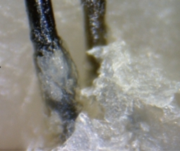 マイナチュレは脂漏性皮膚炎による脱毛症にも効果がある?上手な使い方とは?